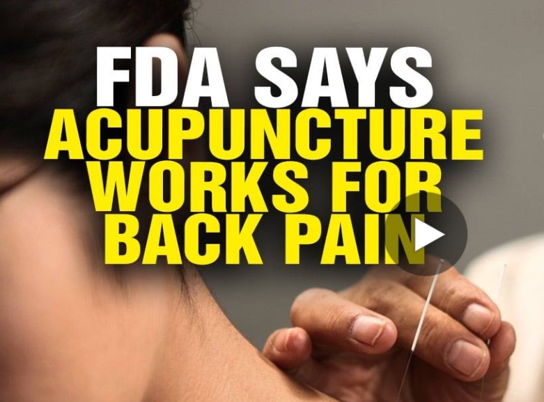 FDA Wants Doctors to Recommend Acupuncture and Chiropractic care for Back Pain